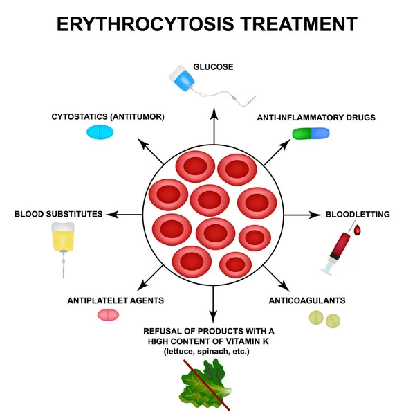 Tratamento da eritrocitose. Aumento dos glóbulos vermelhos. Células eritrócitos. Hemoglobina. A estrutura dos glóbulos vermelhos. Infográficos. Ilustração vetorial sobre fundo isolado . — Vetor de Stock