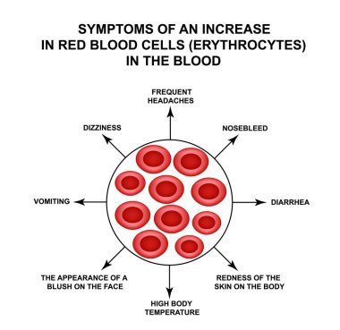 Kandaki kırmızı kan hücrelerinde artışın belirtileri. Hücre eritrositleri. Hemoglobin. Kırmızı kan hücrelerinin yapısı. Bilgi grafikleri. İzole edilmiş arkaplanda vektör illüstrasyonu.