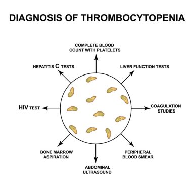 Diagnosis of thrombocytopenia. Lowering platelets in the blood. Infographics. Vector illustration on isolated background. clipart