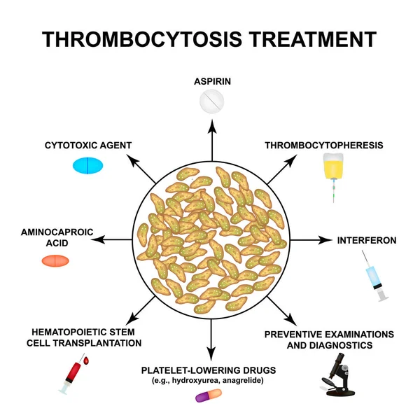 Tratamento da trombocitose. Um aumento das plaquetas no sangue. Infográficos. Ilustração vetorial sobre fundo isolado . — Vetor de Stock