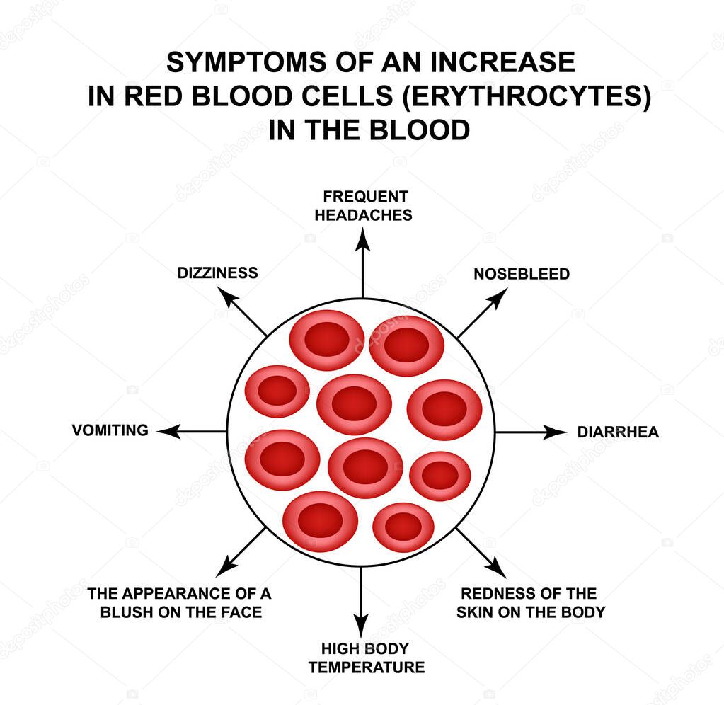 Symptoms of an increase in red blood cells in the blood. Cells erythrocytes. Hemoglobin. The structure of red blood cells. Infographics. Vector illustration on isolated background.