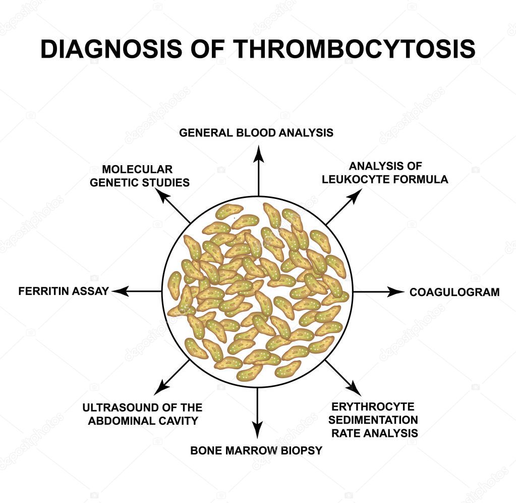 Diagnosis of thrombocytosis. An increase in platelets in the blood. Infographics. Vector illustration on isolated background.
