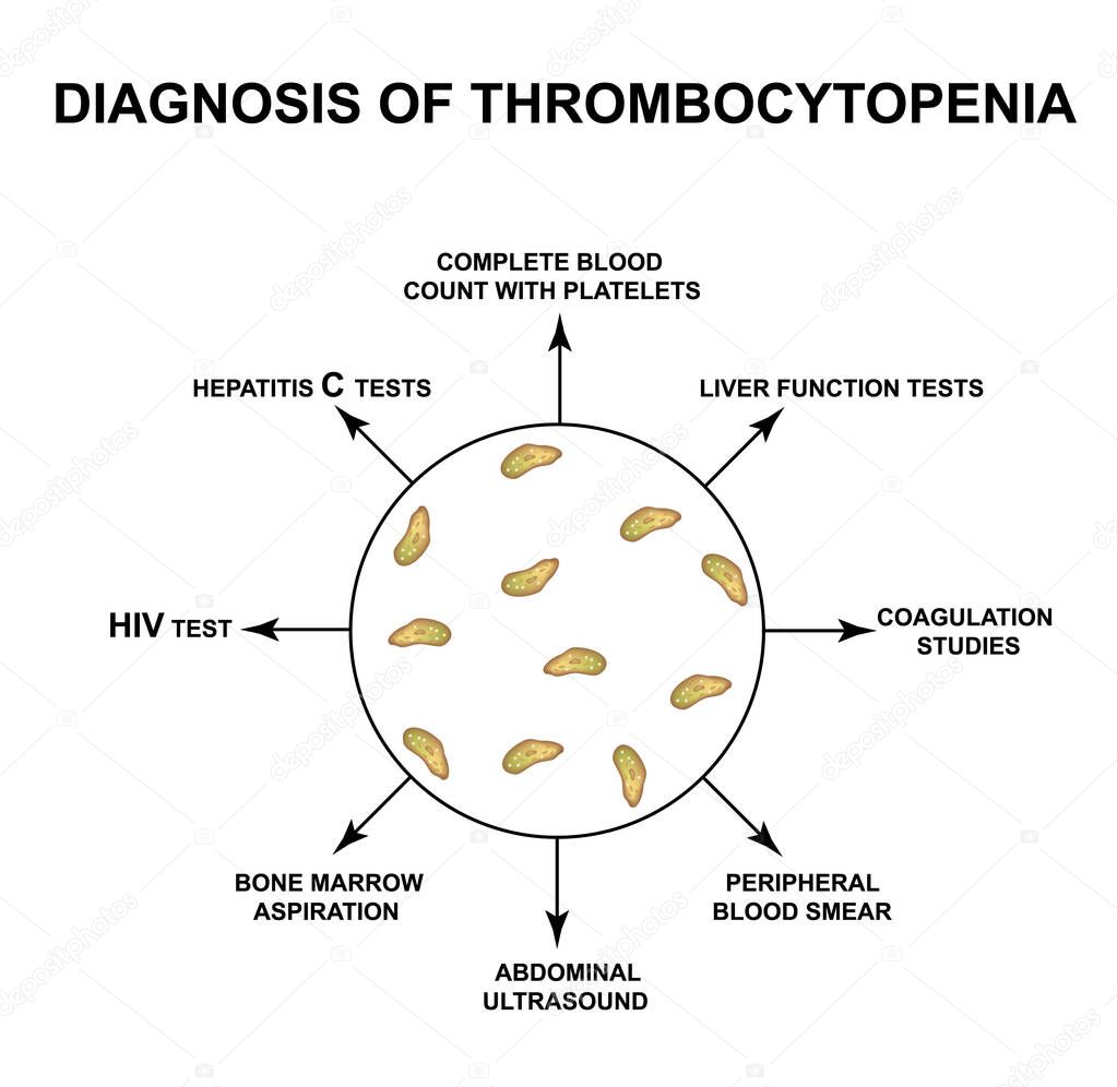 Diagnosis of thrombocytopenia. Lowering platelets in the blood. Infographics. Vector illustration on isolated background.