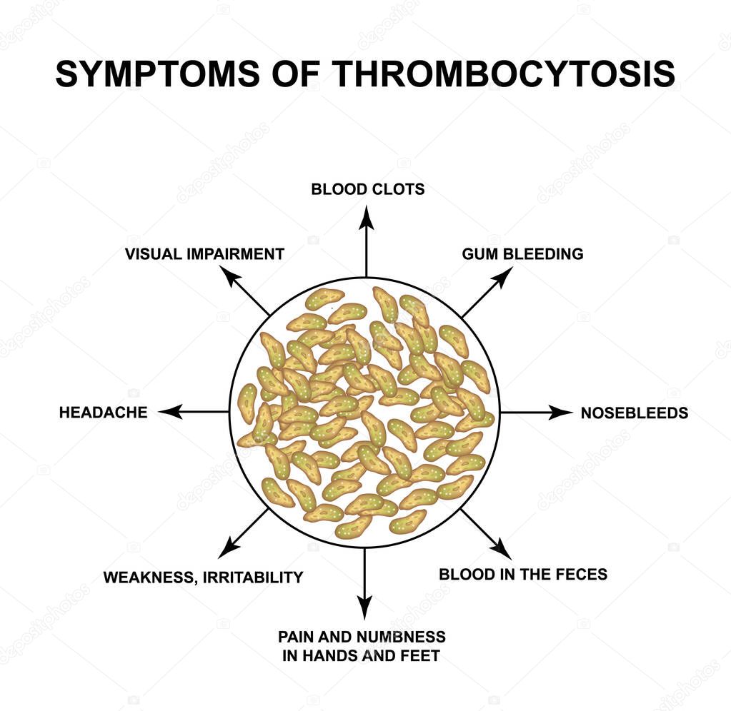 Symptoms of thrombocytosis. An increase in platelets in the blood. Infographics. Vector illustration on isolated background.