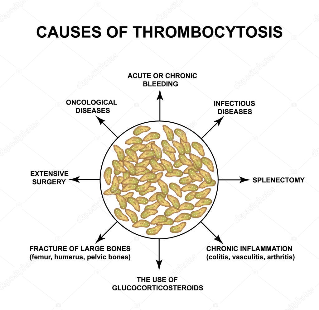Causes of thrombocytosis. An increase in platelets in the blood. Infographics. Vector illustration on isolated background.