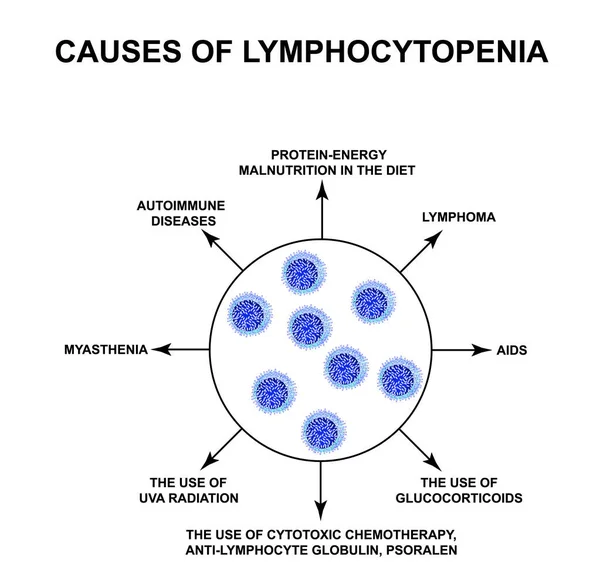 Causas de linfocitopenia. Disminución de linfocitos en la sangre. Infografías. Ilustración vectorial sobre fondo aislado . — Vector de stock