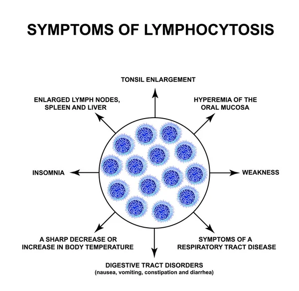 Symtom på lymfocytos. Ökningen av lymfocyter i blodet. Cellmördare. Immunitetens hjälpceller. Infografik. Vektor illustration på isolerad bakgrund. — Stock vektor