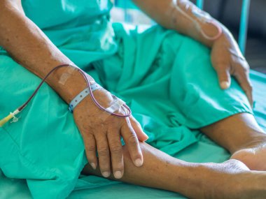 Asyalı üst düzey bir hastaya yakın çekim. Hastanede kan solüsyonu yapılıyor. Mide kanaması tedavisi. Yaşlılar ve sağlık hizmetleri kavramı