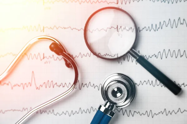 Stetoskop a zvětšovací sklo leží na list s EKG detailní pohled shora — Stock fotografie