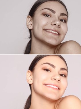 Sağlık, insan, gençlik ve güzellik kavramı - önce ve sonra kozmetik işlemi. Genç güzel kadın portre. Önce ve sonra kozmetik veya plastik yordamı Anti-yaş terapi, tedavi