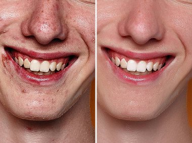 Önce ve sonra kozmetik işlemi. Genç adam portre studio arka plan. Önce ve sonra kozmetik veya plastik yordam, Anti-yaş tedavisi, akne, kaldırılması rötuş. Stüdyo vurdu
