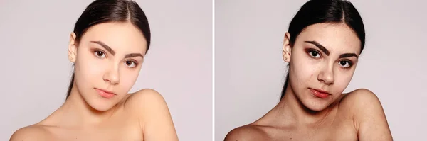 Saúde Pessoas Juventude Conceito Beleza Antes Depois Operação Cosmética Retrato — Fotografia de Stock