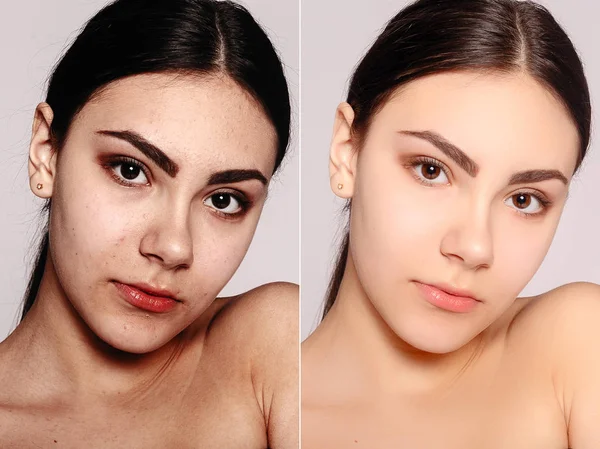 Saúde Pessoas Juventude Conceito Beleza Antes Depois Operação Cosmética Retrato — Fotografia de Stock