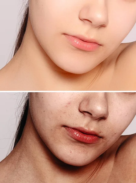 Sağlık Insan Gençlik Güzellik Kavramı Önce Sonra Kozmetik Işlemi Genç — Stok fotoğraf