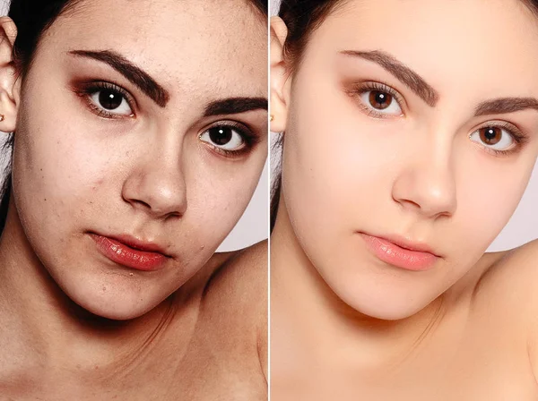 health, people, youth and beauty concept - Before and after cosmetic operation. Young pretty woman portrait. Before and after cosmetic or plastic procedure anti-age therapy, treatment