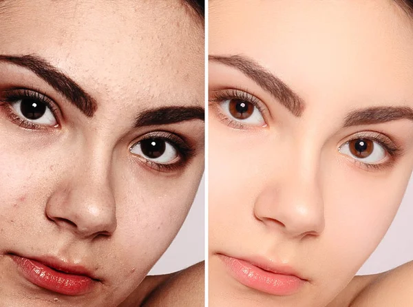 Saúde Pessoas Juventude Conceito Beleza Antes Depois Operação Cosmética Retrato — Fotografia de Stock