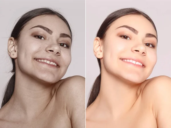 Gezondheid Mensen Jeugd Schoonheid Concept Voor Cosmetische Operatie Jonge Mooie — Stockfoto