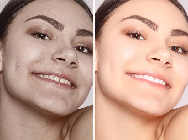 Saúde Pessoas Juventude Conceito Beleza Antes Depois Operação Cosmética Retrato — Fotografia de Stock