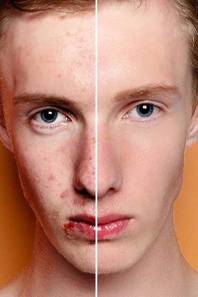 Before and after cosmetic operation. Young man portrait, studio background. Before and after cosmetic or plastic procedure, anti-age therapy, removal of acne, retouching. studio shot