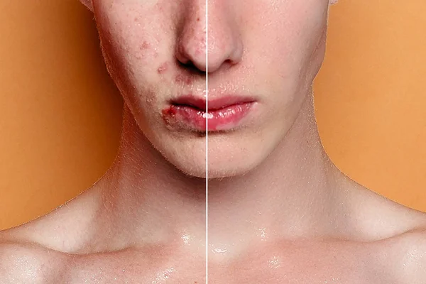 Vóór Cosmetische Operatie Jongeman Portret Studio Achtergrond Voor Cosmetische Plastic — Stockfoto