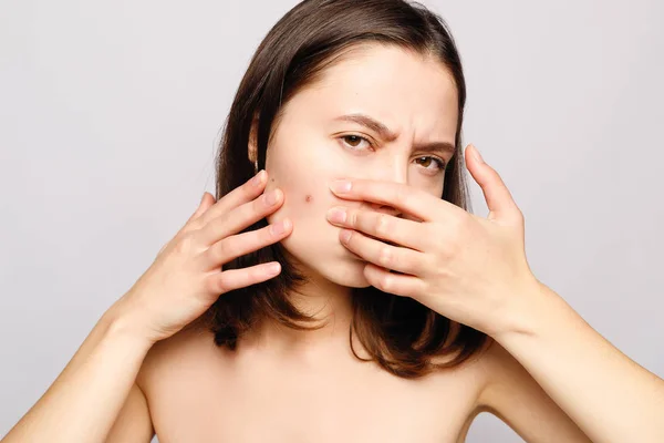 Retrato Jovem Mulher Atraente Tocando Seu Rosto Procura Acne Headshot — Fotografia de Stock