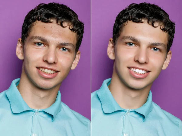 Before and after cosmetic operation. Young man portrait. Before and after cosmetic or plastic procedure, anti-age therapy, removal of acne, retouching. studio shot