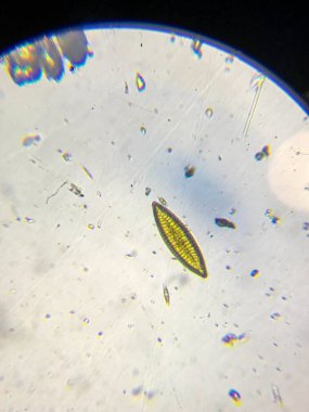 Mikroskop altında göl suyu, mikroplar