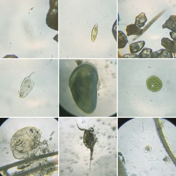 늪에서 미생물들이 현미경으로 — 스톡 사진