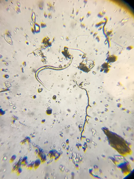 Вода Озере Микроскопом Микробы — стоковое фото
