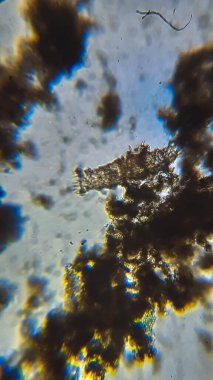 Mikro balçık küfü ve Mor sülfür bakterisi Ostracod 'un ölü kabuğunda bileşik mikroskop altında PSB.