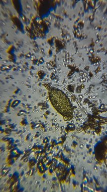 Mikro balçık küfü ve Mor sülfür bakterisi Ostracod 'un ölü kabuğunda bileşik mikroskop altında PSB.