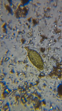 Mikro balçık küfü ve Mor sülfür bakterisi Ostracod 'un ölü kabuğunda bileşik mikroskop altında PSB.