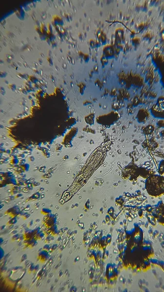 오스트 라코 오드의 죽은 껍질 속에 있는 검은 곰팡이와 보라색 황 박테리아 PSB 화합물 현미경으로 본 균주. — 스톡 사진