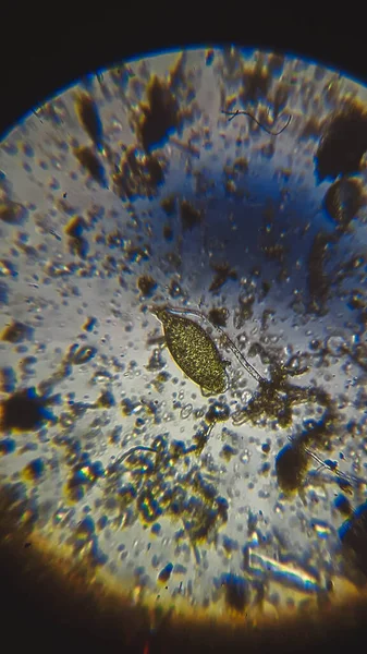 오스트 라코 오드의 죽은 껍질 속에 있는 검은 곰팡이와 보라색 황 박테리아 PSB 화합물 현미경으로 본 균주. — 스톡 사진