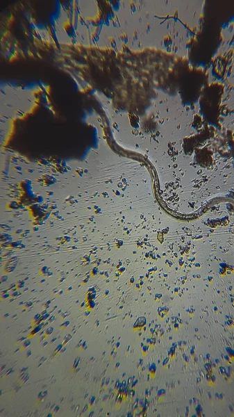 Mycetozoa Slime Mold Purple Sulfur Bacteries Psb Dead Shell Ostracod — стокове фото
