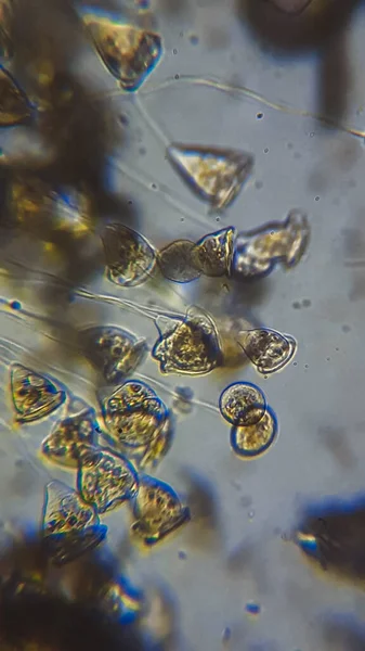 Mycetozoa Μούχλα Γλίτσας Και Μοβ Βακτήρια Του Θείου Psb Νεκρό — Φωτογραφία Αρχείου