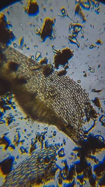Mycetozoa Slime Mold Purple Sulfur Bacteries Psb Dead Shell Ostracod — стокове фото