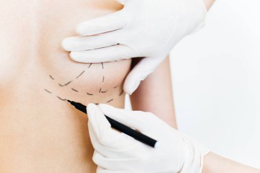 plastik cerrah iş başında