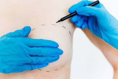 plastik cerrah iş başında