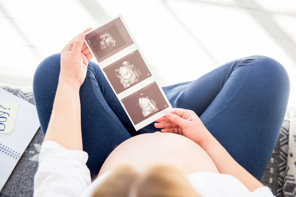 Gravid kvinna som håller ultraljudsbilden av hennes framtida barn — Stockfoto