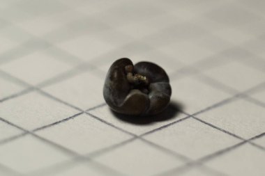 Böbrek taşı oksalatı. Boyutu 4.7 mm. Taş bileşimi wevellite ve weddellite 'dir.. 