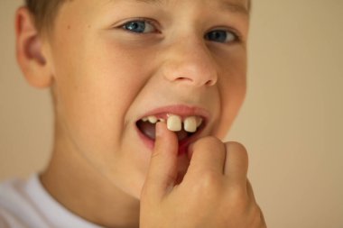 Beyaz tişörtlü 7-10 yaşlarında bir çocuk bej arka planda parmağı ile dişini sallıyor..