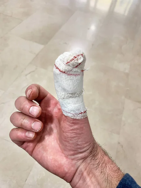 Work accident with the big toe of a bandaged hand