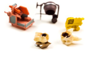 küçük minyatür figürler işçi ulaşım beyaz arka plan üzerinde uzak sorunlu diş üzerinde çalışarak süt diş molar büyük çürüğü ile sorun giderme