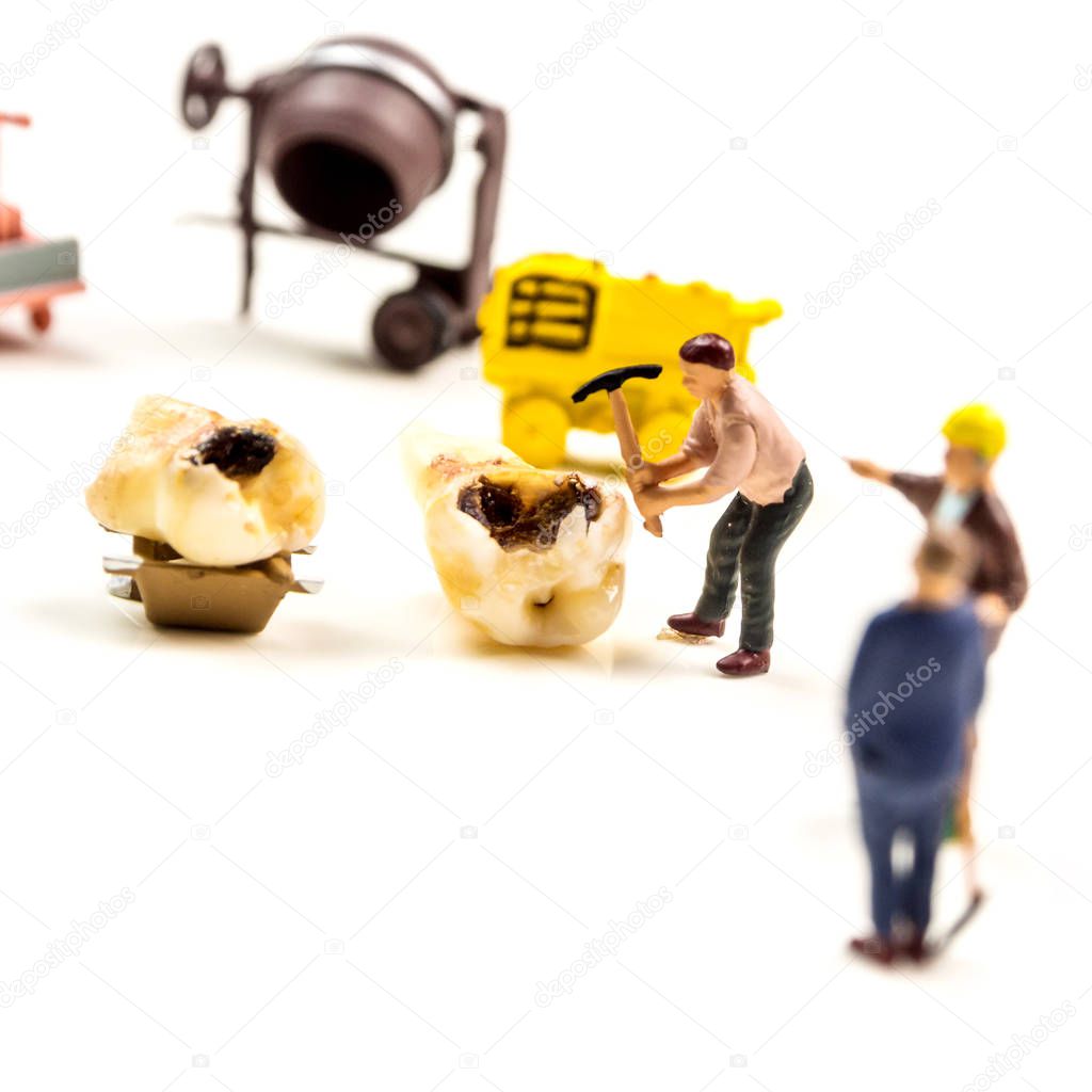 little miniature figurines workers fixing the problem with big caries on milk tooth molar by working on transportation of problematic tooth away on white background