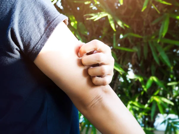 Mujer Joven Con Arañazos Mano Brazo Por Enfermedad Piel Del — Foto de Stock