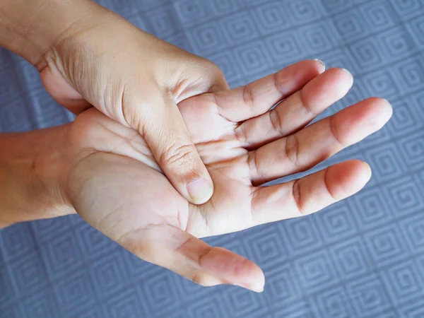 Mujer Que Sufre Dolor Manos Palmas Las Manos Síntoma Beriberi — Foto de Stock