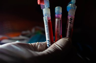Profesyonel doktor ya da laboratuvar teknisyeni elinde yeni bir Coronavirus N.C.P. örneği tutuyor. İlk olarak Wuhan, Hubei Eyaleti, Çin, Sağlık ve Sağlık Hizmetleri 'nde teşhis edildi.