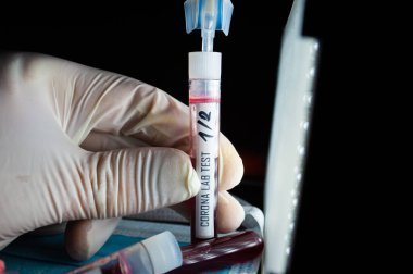 Profesyonel doktor ya da laboratuvar teknisyeni elinde yeni bir Coronavirus N.C.P. örneği tutuyor. İlk olarak Wuhan, Hubei Eyaleti, Çin, Sağlık ve Sağlık Hizmetleri 'nde teşhis edildi.