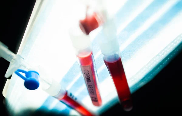 Médico Profesional Técnico Laboratorio Que Sostiene Muestra Sangre Con Nuevo —  Fotos de Stock